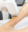 Epilation laser et soins esthetiques