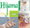 medecin  fait l' hijama a domicil