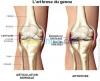 ARTHROSE RHUMATOLOGIE