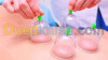 hijama حجامة