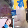 frozen collagen 2 in 1 whitening x10