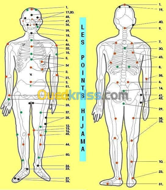 HIJAMA et MESOTHERAPIE...Urgences..