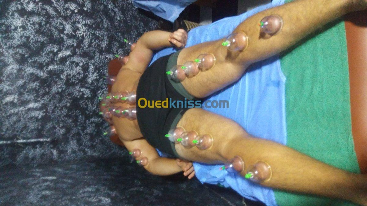 (Cupping thérapie)الحجامة و التدليك