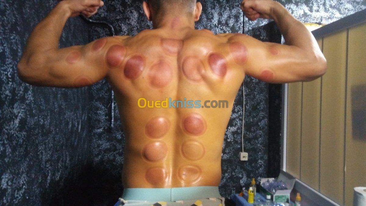 (Cupping thérapie)الحجامة و التدليك