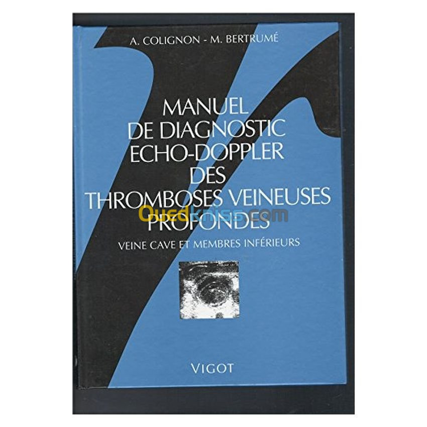 Manuel de diagnostic écho-doppler des thromboses veineuses profondes