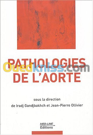 Pathologies de l'aorte