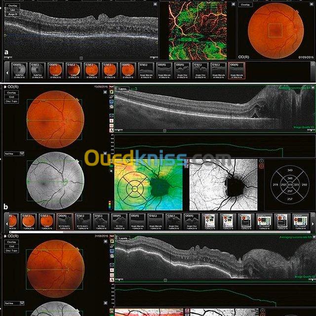 Angiographie En Flurescence Numeris E Alger Alg Rie