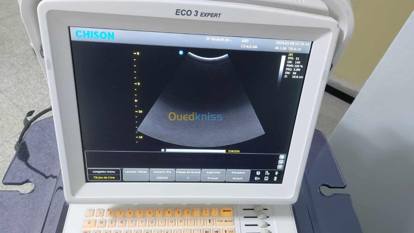 ECHODOPPLER CHISON ECO 3 Expert. Etat presque neuf tres peu utilise