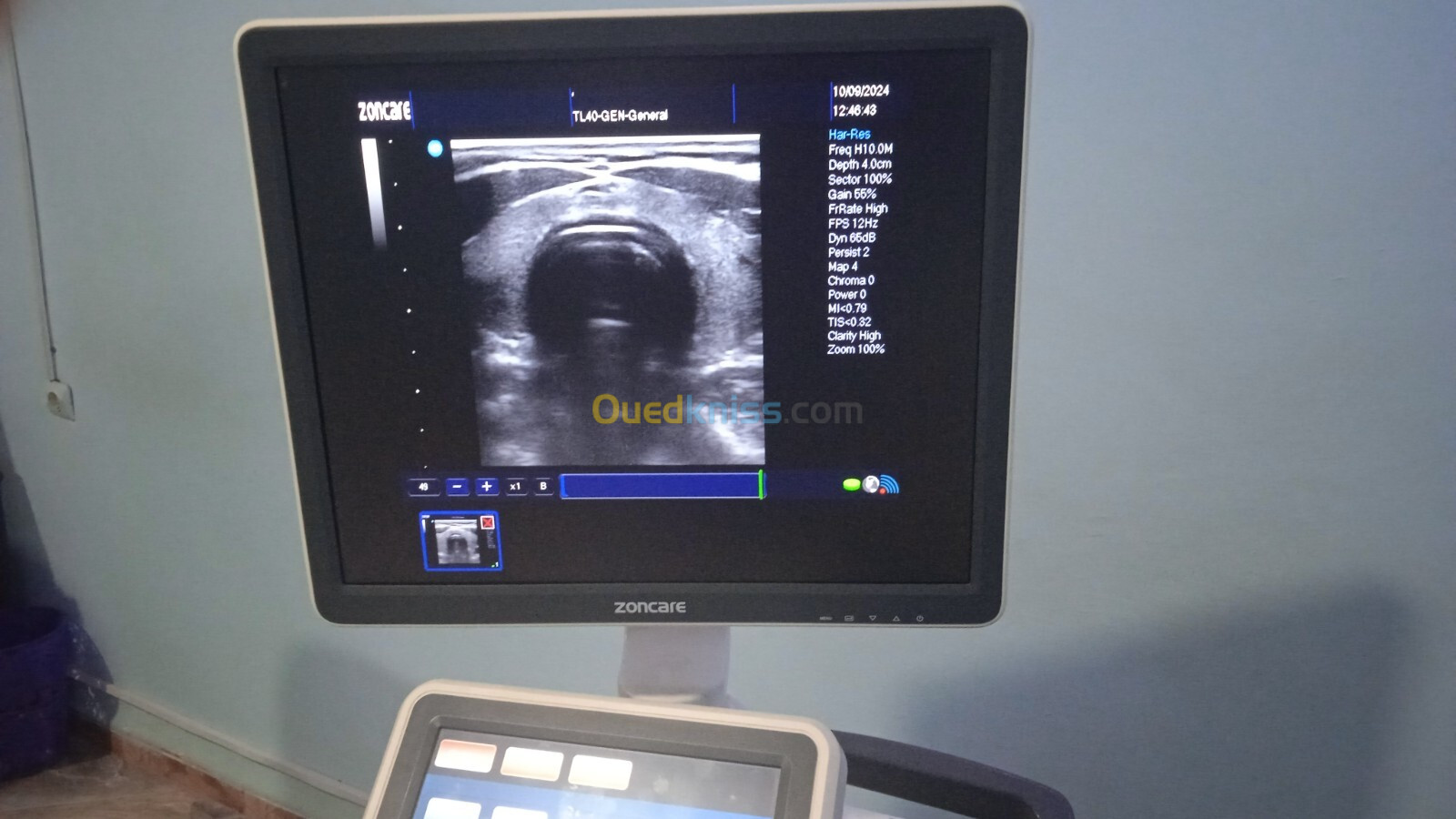 Echographe ZonCare Q9