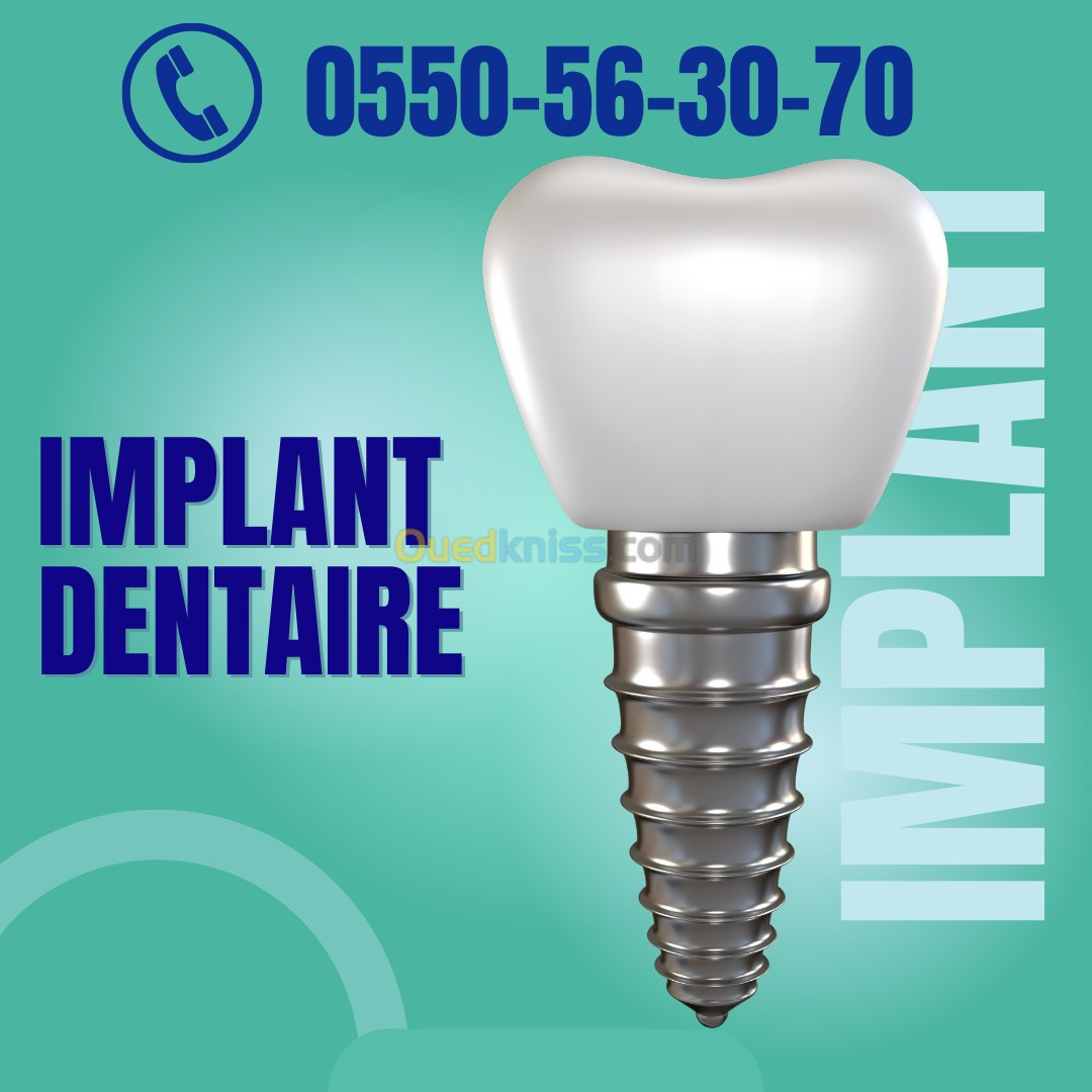 Implant Dentaire