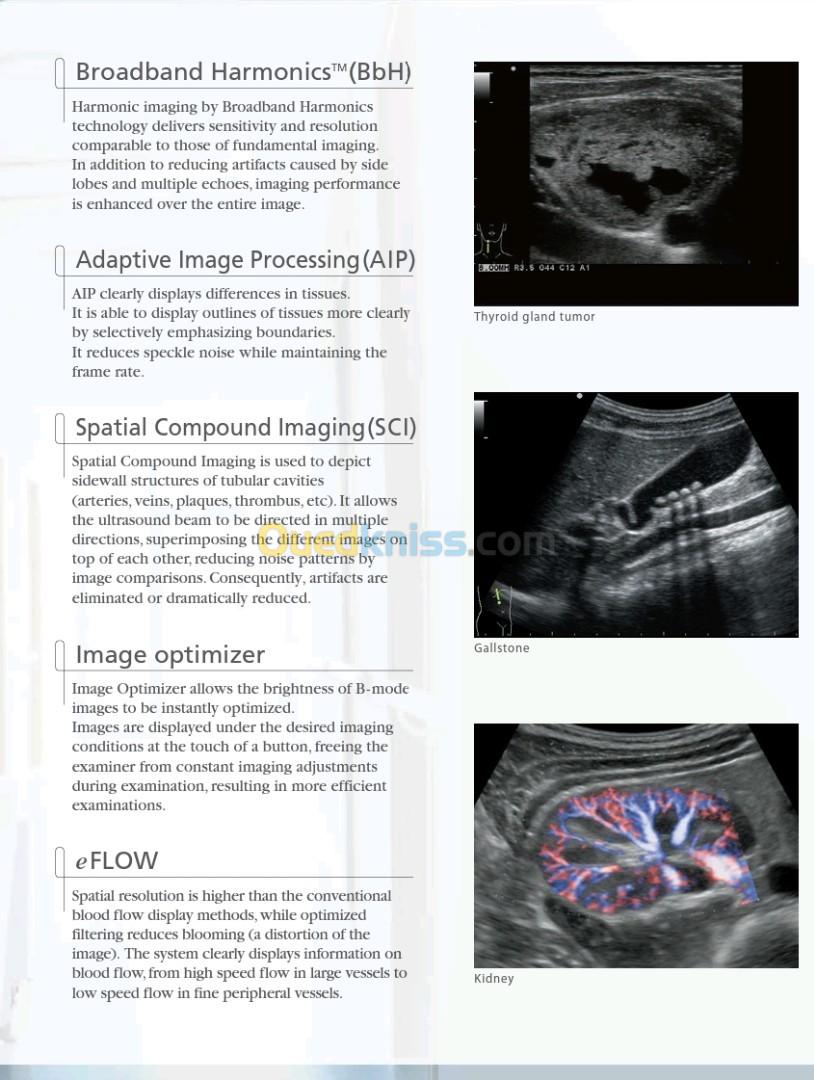 ECHOGRAPHE ALOKA ALPHA 6 