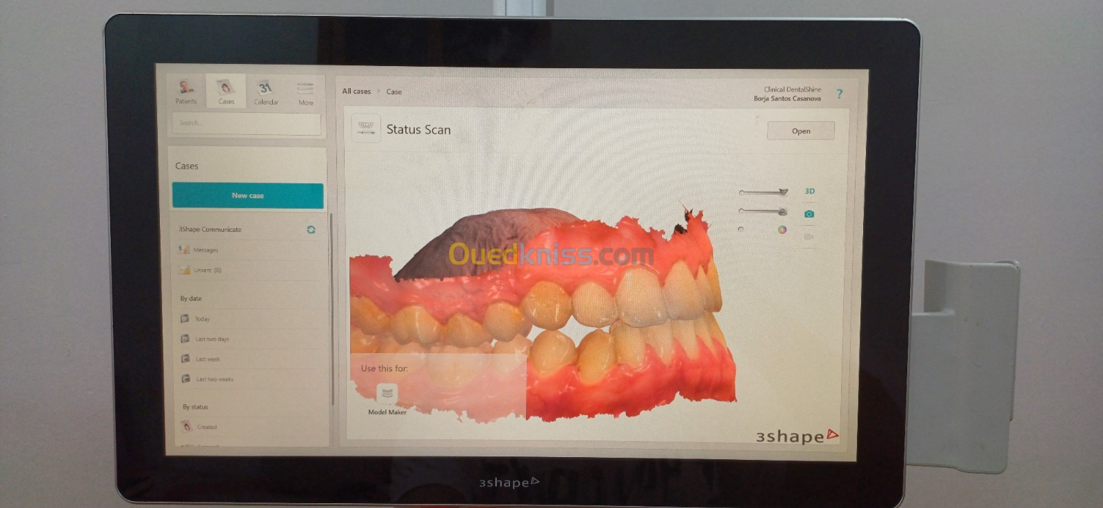 Scanner intraoral 3Shape TRIOS