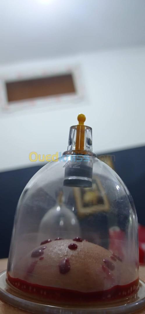 hijama a domicile حجامة