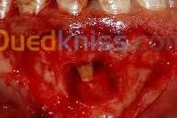 الجزائر-عين-النعجة-طب-و-صحة-chirurgie-buccale