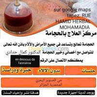 الجزائر-المحمدية-طب-و-صحة-hidjama-incisiothÉrapie