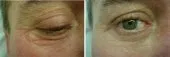 Médecine esthétique et Mesotherapie  