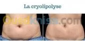 Cryolipolyse