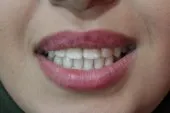 chirugien dentiste 
