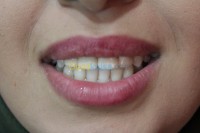 الجزائر-القبة-طب-و-صحة-chirugien-dentiste&nbsp;