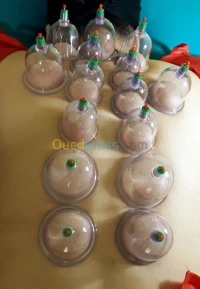 Seance de Cupping (الحجامة) 
