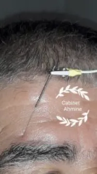 KINESITHERAPIE ACUPUNCTURE RÉÉDUCATION