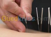 الجزائر-بئر-خادم-طب-و-صحة-&nbsp;l-auriculothérapie-et-acupuncture