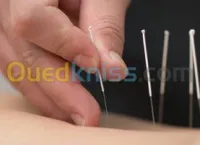  l'Auriculothérapie et Acupuncture 