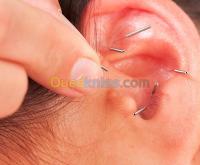 الجزائر-بئر-خادم-طب-و-صحة-l-auriculotherapie