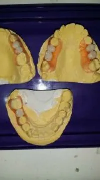 prothésistes dentaire