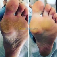 وهران-الجزائر-تجميل-و-جمال-pedicure-madical