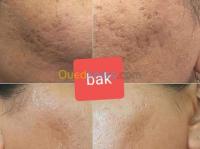 الجزائر-وسط-تجميل-و-جمال-soin-d-esthétique