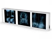 VENTE MATRIEL MEDICALE