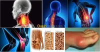 Spécialisé Acupuncture Hijama Médical7