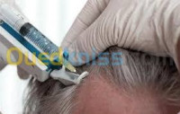 esthetique-beaute-mesotherapie-pour-la-chute-des-cheveux-bab-el-oued-alger-algerie