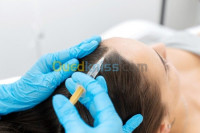 esthetique-beaute-mesotherapie-pour-la-chute-des-cheveux-bab-el-oued-alger-algerie