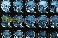 وهران-بئر-الجير-الجزائر-طب-و-صحة-neurologie