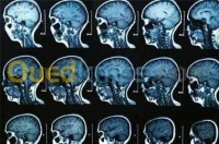 وهران-بئر-الجير-الجزائر-طب-و-صحة-consultation-spécialisé