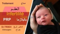 Traitement sterilité PRP علاج العقم