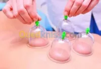  الحجامة الطبية البليدة