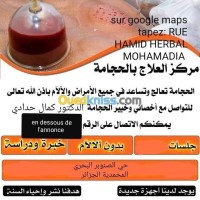 الجزائر-باب-الزوار-طب-و-صحة-hidjama-عند-طبيب-مختص