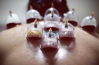 وهران-الجزائر-طب-و-صحة-hijama