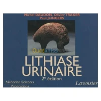 Lithiase urinaire