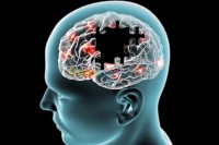 عنابة-الجزائر-طب-و-صحة-potentiels-Évoqués-sensitifs-pes
