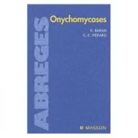 Onychomycoses abrégés