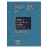 Reprises de prothèses totales du genou n° 84