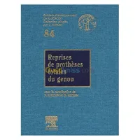 Reprises de prothèses totales du genou n° 84