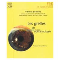 الجزائر-درارية-كتب-و-مجلات-les-greffes-en-ophtalmologie