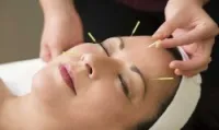 Acupuncture_ Dr khamchane Linda
