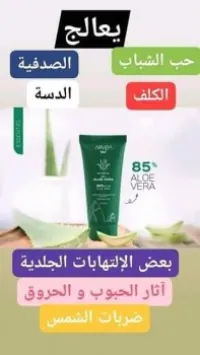 Alovera الوفيا