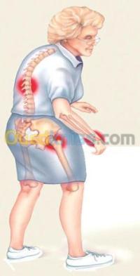 الجزائر-باب-الزوار-تجميل-و-جمال-برامج-غذائية-لهشاشة-العظام